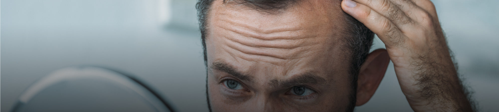 "Pre-Planning" For Hair Loss