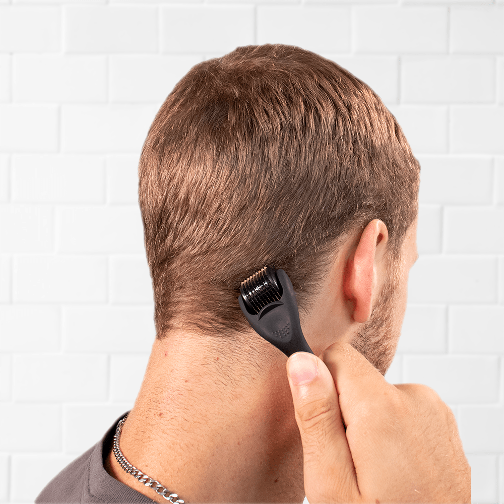 dht-blocking-products Derma Roller