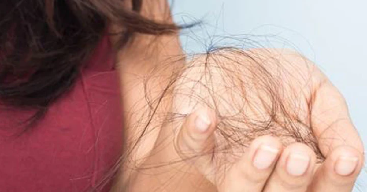 Top 10 Hair Loss Myths–The Truth Revealed