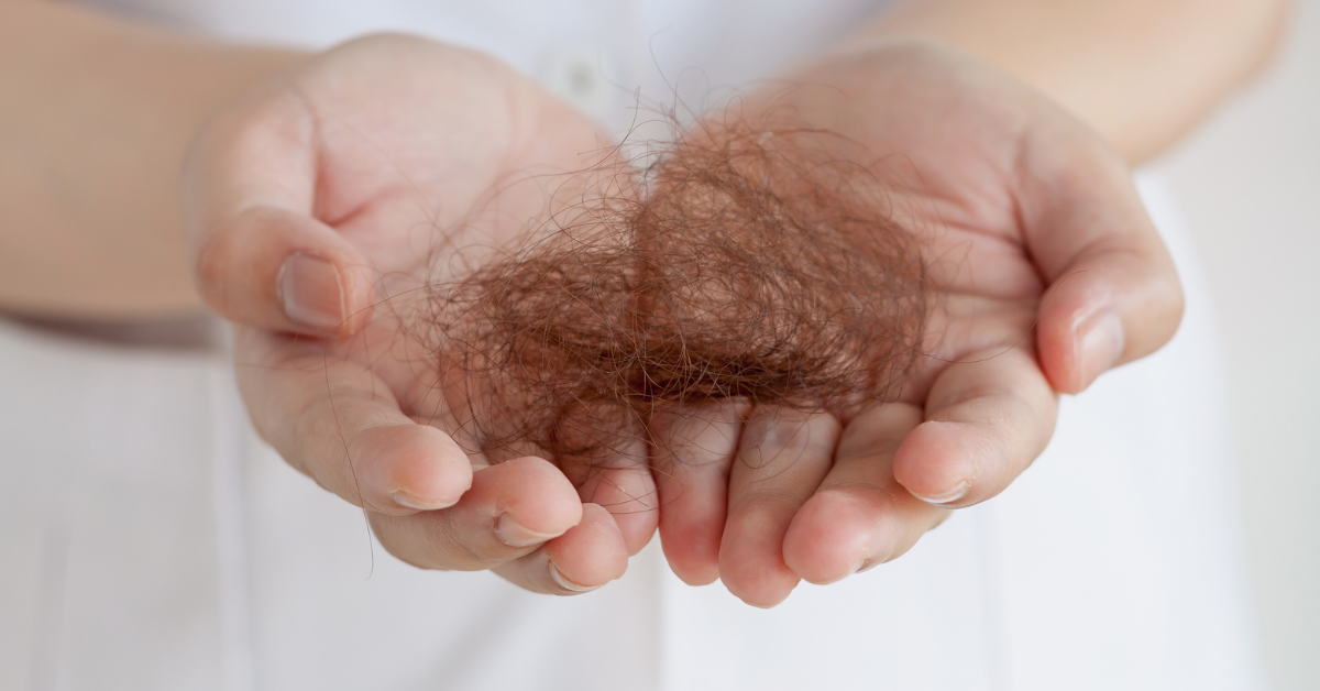 hair loss after hair treatment