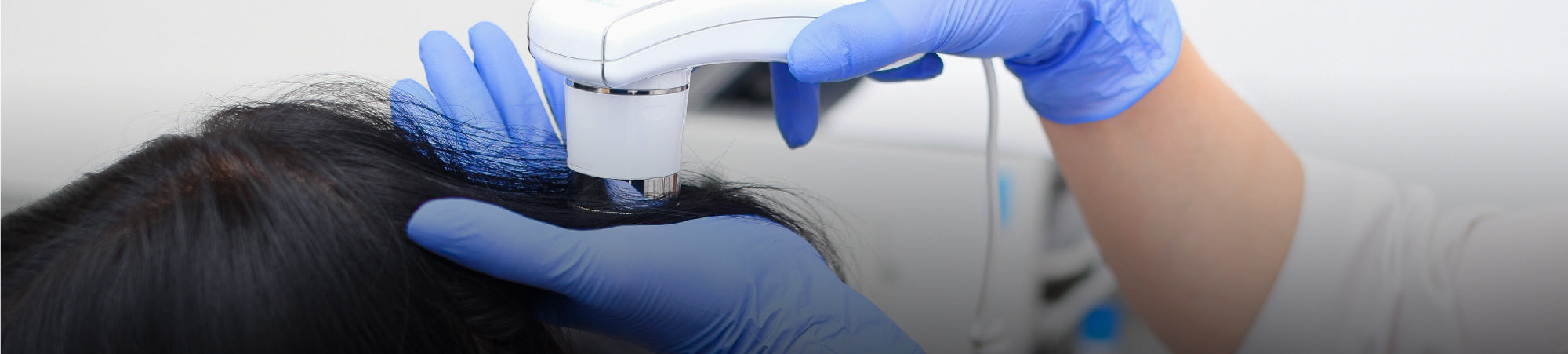 When Hair Loss May Not Be Caused By Genetics