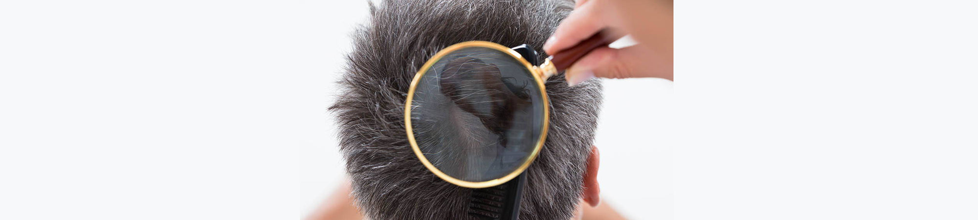 Understanding The Hair Cycle