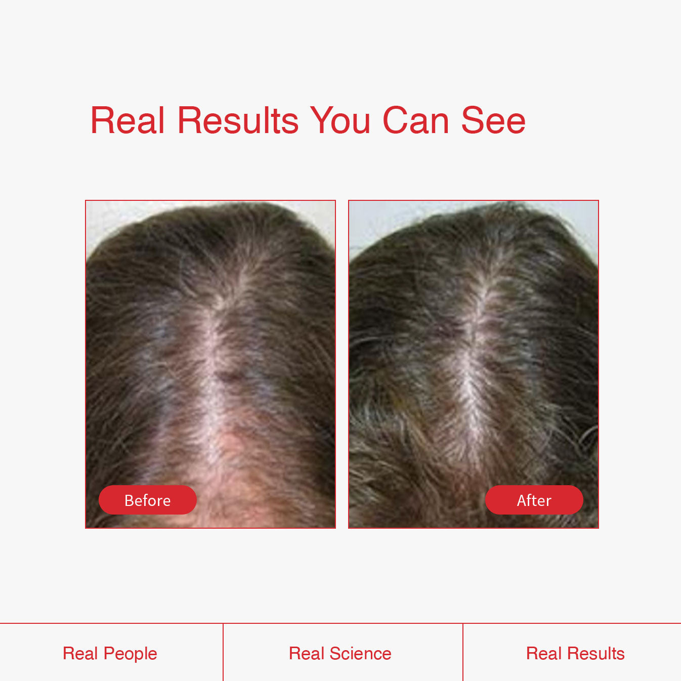 Biotin Peptide Shampoo, Conditioner, and Thickening Serum Bundle