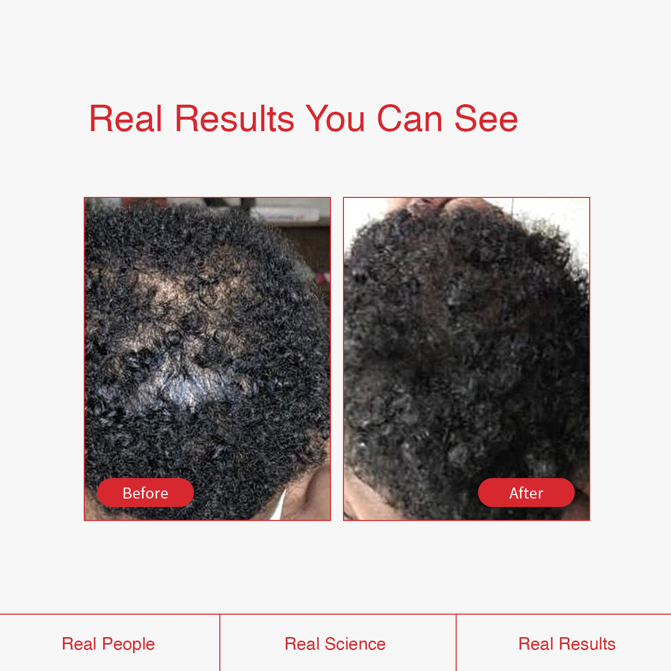 Hair Growth Oil for Curly, Coily & Textured Hair