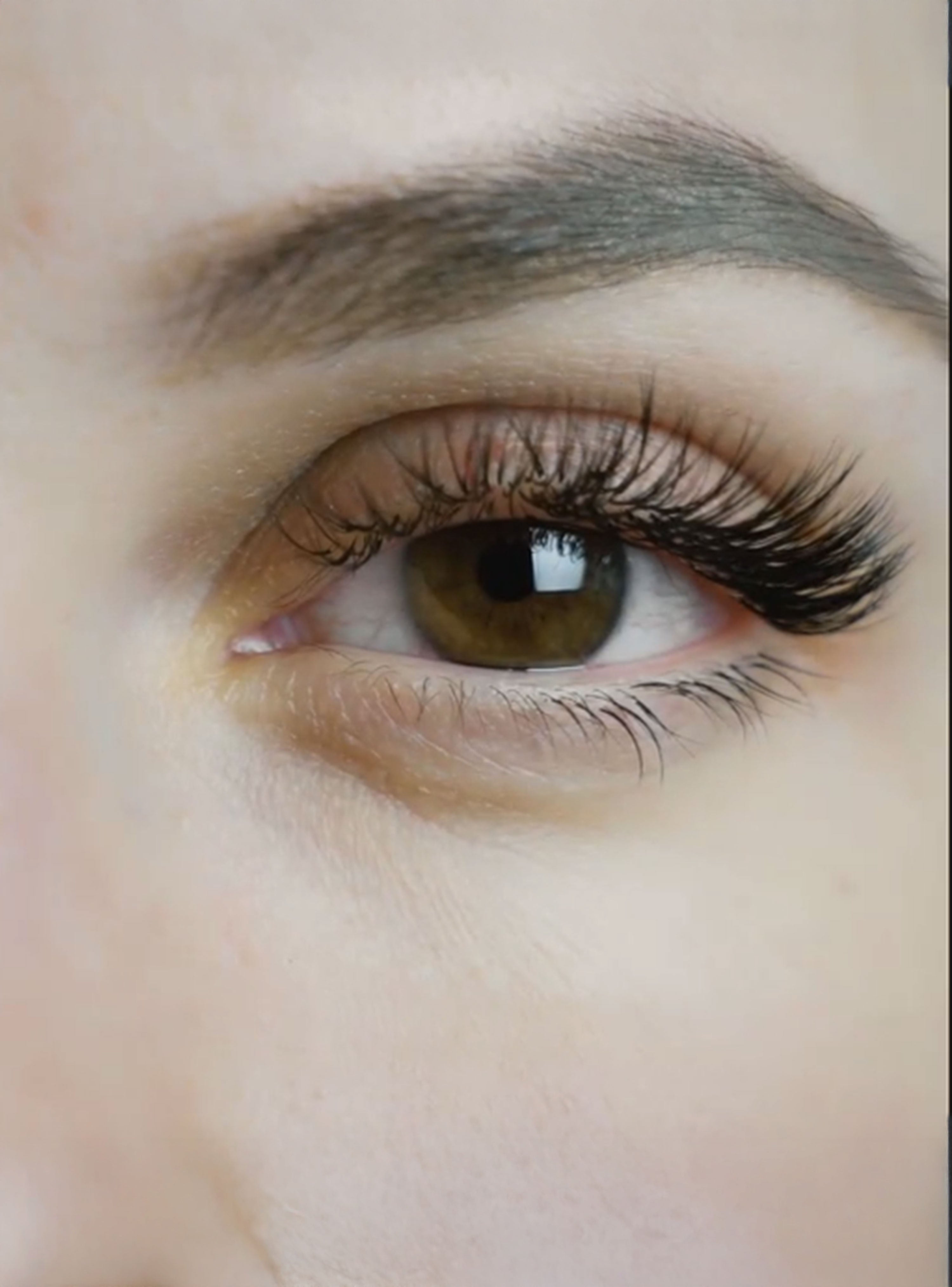 Hair Restoration Laboratories 