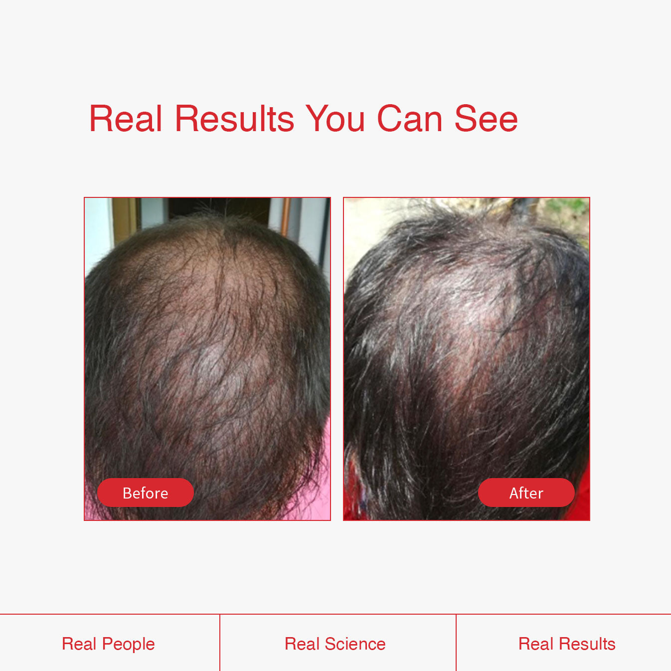 Pro Strength Shampoo, Conditioner, Thickening Serum, and Supplement Bundle