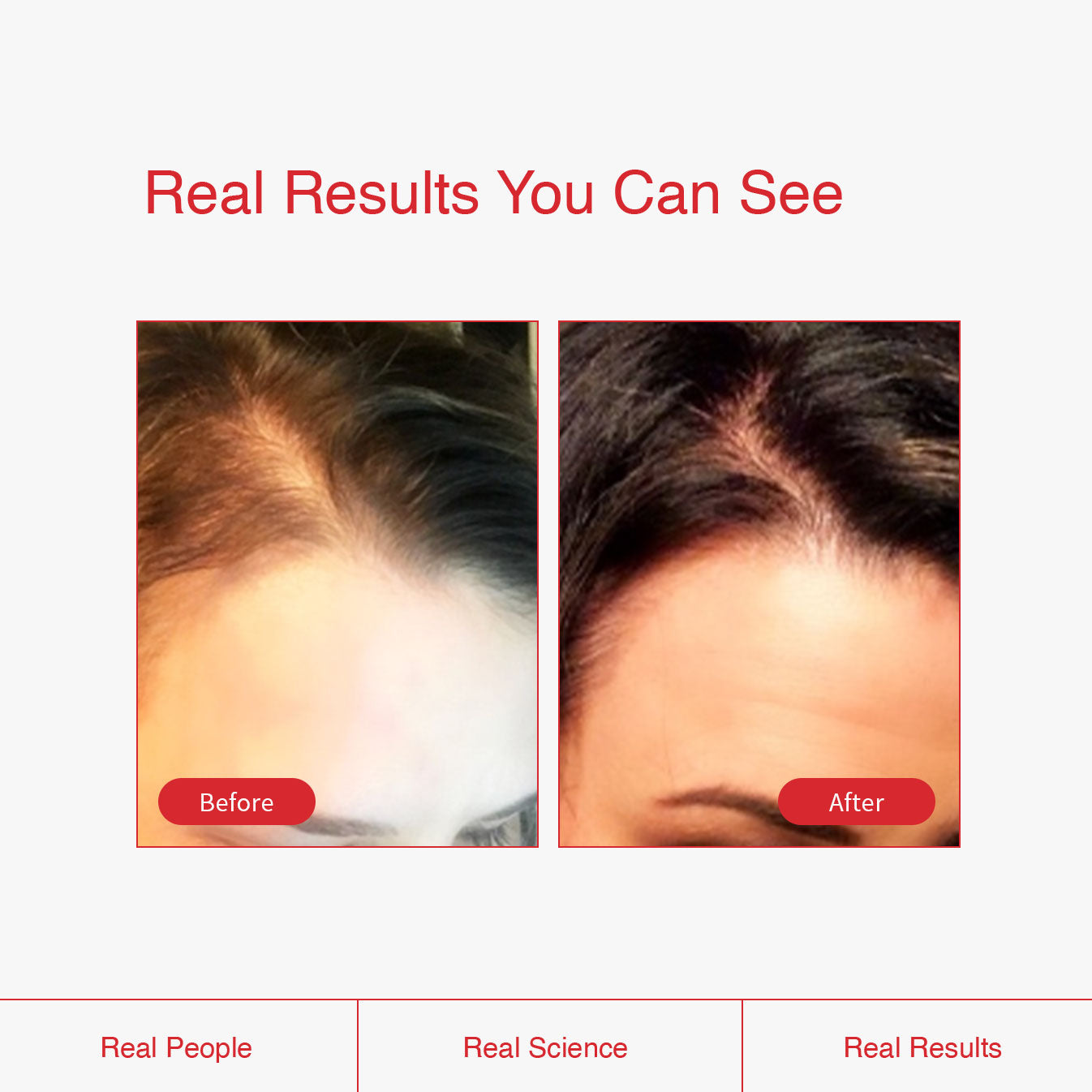 Hair Restore Shampoo and Conditioner Bundle