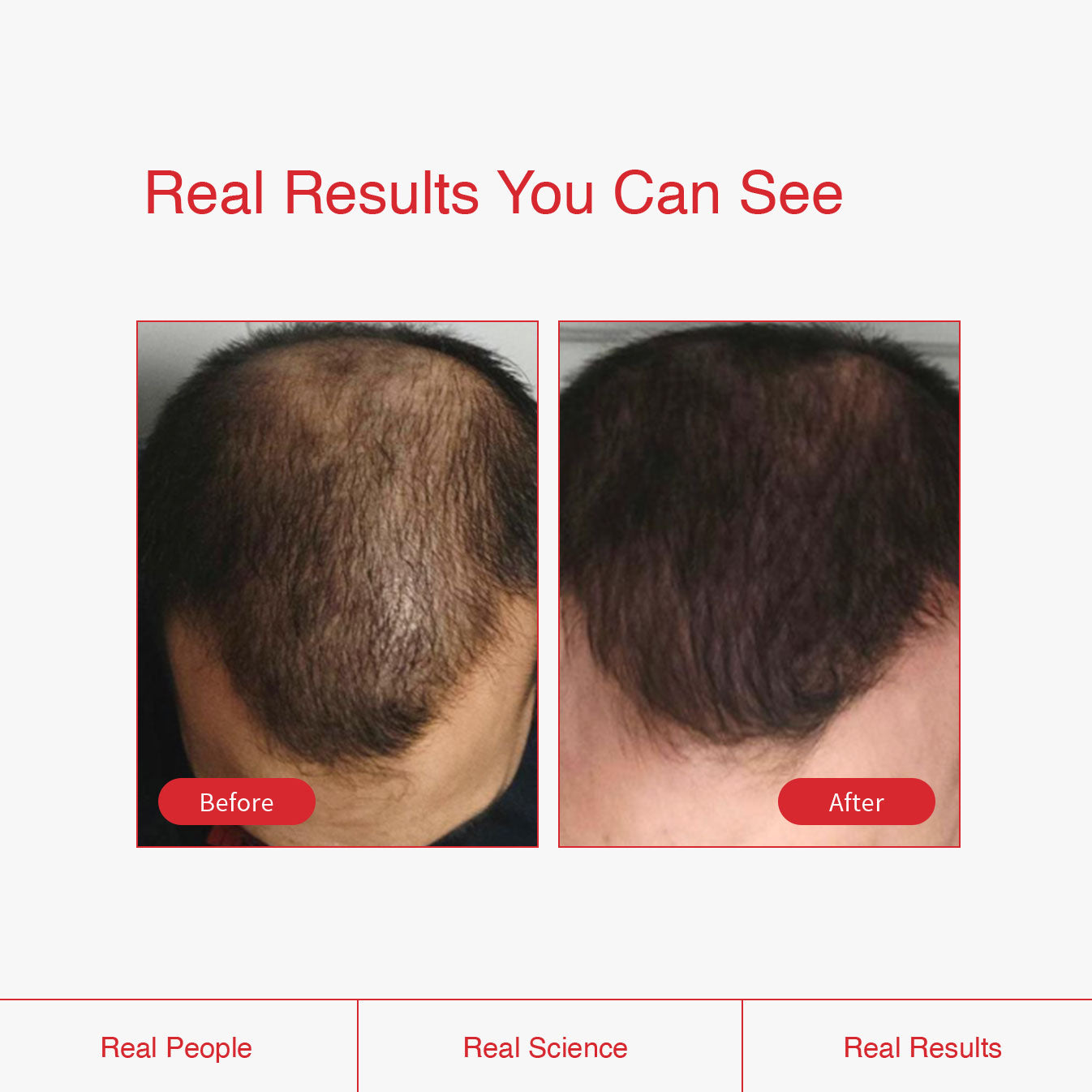 Maximum Hair Thickening Serum