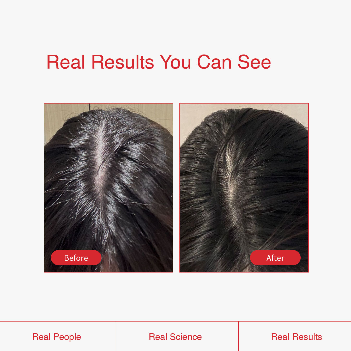 Biotin Boost Supplement