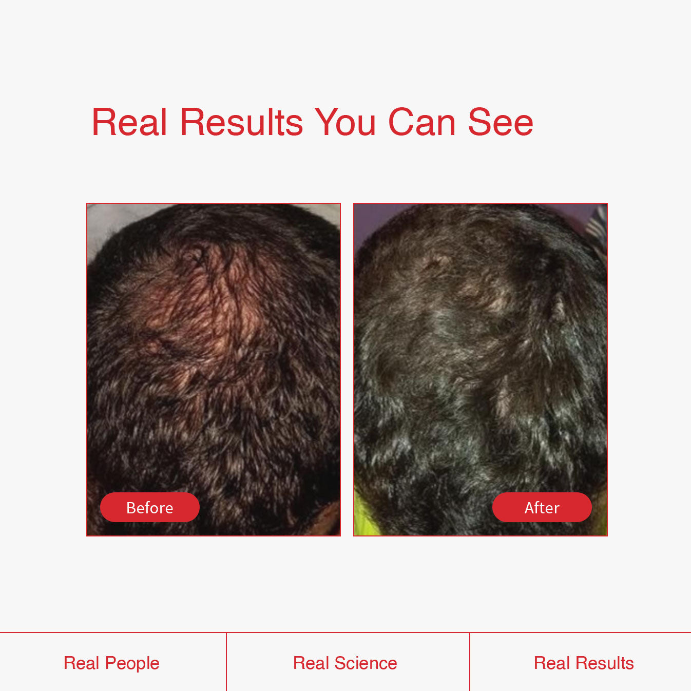Biotin Boost Supplement